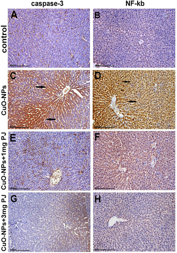 Figure 6 Immunohistochemical expression of caspase-3 and NF-ĸB protein in the liver sections in different groups showing (A and B) mild to negative Caspase-3 and NFĸB protein expression in control negative group. (C and D) Strong positive caspase-3 and extensive nuclear translocation of NF-ĸB protein within hepatocytes in the group intoxicated with CuO-NPs. (E and F) Moderate positive caspase-3 and NF-ĸB protein expression in the group pretreated with 1 mL/kg bwt PJ. (G and H) Mild to negative caspase-3 and NF-ĸB protein expression in the group treated with 3 mL/kg bwt PJ.