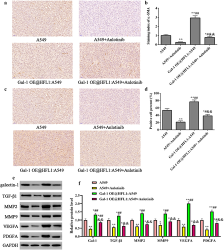 Figure 7. IHC detected α-SMA, and Ki67 protein expression in vivo. (a) IHC staining of α-SMA protein in xenograft tumors. (b) The staining index of α-SMA. (c) IHC staining of Ki67 protein in xenograft tumors. (d) Positive cell percent of Ki67. Scale bar: 50 μm. (e) Western blotting was conducted to measure MMP2, MMP9, TGF-β1, VEGFA, PDGFA. (f) The qualification of proteins expression in different groups. vs A549 group, *p < .05, **p < .01; vs A549+Anlotinib group, #p < .05, ##p < .01; vs gal-1 OE@HFL1:A549 group, &p < .05, &&p < .01.