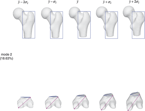Figure 17. Femur atlas: 18.63% of the shape variation is encoded in the second mode. The color shapes highlight the local shape variation.
