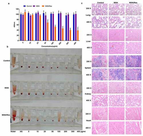 Figure 2. Cytotoxicity assay of Res-loaded MSN