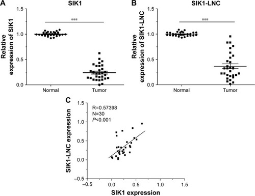 Figure 1 Relative SIK1 and SIK1-LNC expressions in 30 lung cancer tissues were examined by RT-qPCR and normalized to GAPDH expression. (A) Both SIK1 and (B) SIK1-LNC expression were comparatively down-regulated compared to those in matched adjacent normal tissues (P<0.05). (C) Correlation analysis between SIK1 and SIK1-LNC expression revealed that SIK1-LNC expression was closely associated with SIK1 expression (N=30, R=0.57, P<0.05).