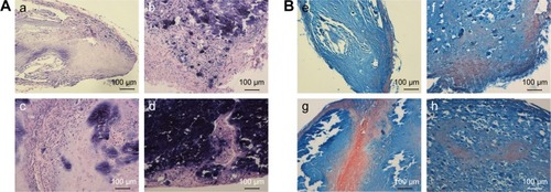 Figure 5 Histological staining images of in vivo ectopic transplantation of hPDLSCs-laden GelMA/nHA microgels.Notes: (A) HE staining; (B) Masson’s trichrome staining. (a) and (e) 10% GelMA (control), (b) and (f) 10%/1% GelMA/nHA, (c) and (g) 10%/2% GelMA/nHA, (d) and (h) 10%/3% GelMA/nHA. Scale bar: 100 μm.Abbreviations: HE, hematoxylin and eosin; GelMA, gelatin methacrylate; nHA, nanohydroxylapatite; hPDLSCs, human periodontal ligament stem cells.