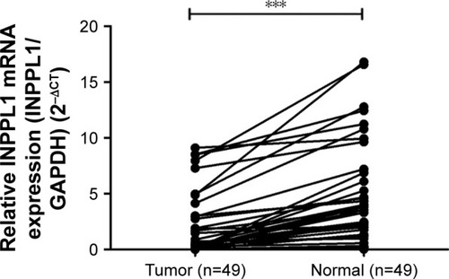 Figure 1 The mRNA expression of INPPL1 in our local cohort (n=49).