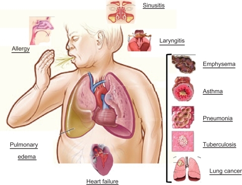 Figure 1 Some causes of cough