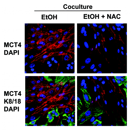 Figure 12. Antioxidant treatment prevents the ethanol-induced upregulation of MCT4 in cancer-associated fibroblasts. MCF7 cells were plated in co-culture with fibroblasts, and cells were treated with 100 mM EtOH for 72 h. Then, 10 mM NAC or vehicle was added for 24 h. Cells were fixed and immunostained with antibodies against MCT4 (red, upper panels) and K8/18 (green, lower panels). Nuclei were counterstained with DAPI (blue). Note that treatment with the antioxidant NAC prevents the upregulation of MCT4 in fibroblasts compartment, as compared with co-cultured fibroblasts in the absence of NAC. Original magnification, 40x.
