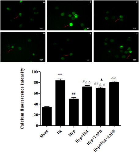 Figure 9. Hyp decreased the Ca2+ concentration in the basilar artery smooth muscle cells of IR rats. Immunofluorescence imaging indicated that the decreased intensity of Ca2+ by Hyp could be reversed by the IP3 receptor blocker 2APB or PKC blocker BisI. (A) Sham, (B) IR, (C) Hyp, (D) HYP + BisI, (E) Hyp + 2APB and (F) Hyp + BisI + 2APB (n = 3). **p < 0.01 vs. sham; #p < 0.05, ##p < 0.01 vs. IR; ΔΔp < 0.01 vs. Hyp; ▲p < 0.05 vs. Hyp + BisI + 2APB. Scale bar = 20 μM.