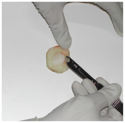 Figure 1 Removal of the epidermis using a scalpel.