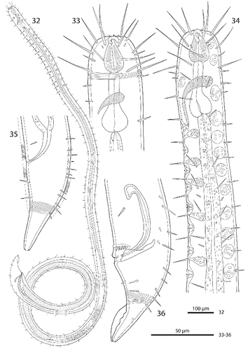 Figs. 32–36. Robbea ruetzleri sp. nov. 32. Male, whole; 33. Female, anterior body region; 34. Male, anterior body region; 35. Female, tail; 36. Male, tail and spicular apparatus.