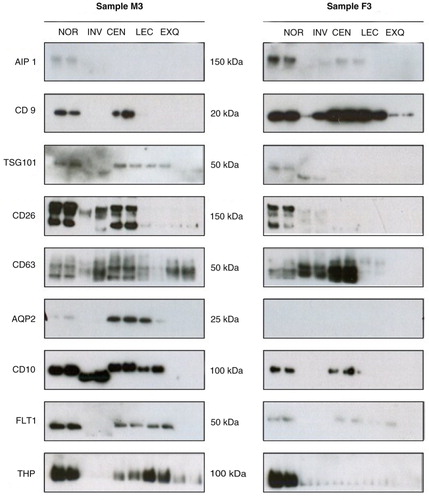 Fig. 2.  Western blot analysis of 2 representative independent biological samples. uEVs were enriched using indicated methodologies, in duplicate. uEV-enriched preparations were analysed by Western blot using antibodies against indicated proteins. Molecular weights are shown.