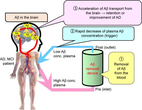 Figure 1 Schematic of extracorporeal blood Aβ removal system.