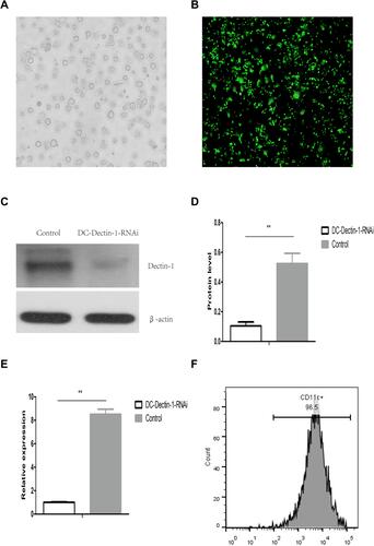 Figure 1 DCs transduced with LV-Dectin-1-RNAi-GFP. (A) mDCs purified with CD11c microbeads. *(×400) (B) The expression of GFP in DCs 72 h after LV-Dectin-1-RNAi-GFP transduction observed in fluorescence microscopy. (×200) (C and D) Western blot analysis of Dectin-1 protein expression in DCs transduced with LV-Dectin-1-RNAi-GFP. n = 3. (E) qRT-PCR analysis of Dectin-1 mRNA expressions in DCs transduced with LV-Dectin-1-RNAi-GFP. GADPH served as an internal control. (F) Purity of CD11c+ DCs. Data represent the mean ± SD. **P < 0.01.