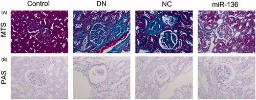 Figure 1. Renal fibrosis in rats of each group. MTS assay (A) or PAS staining (B) was performed, respectively, to measure the cell proliferation of control group, DN group, NC group, and miR-136 group.