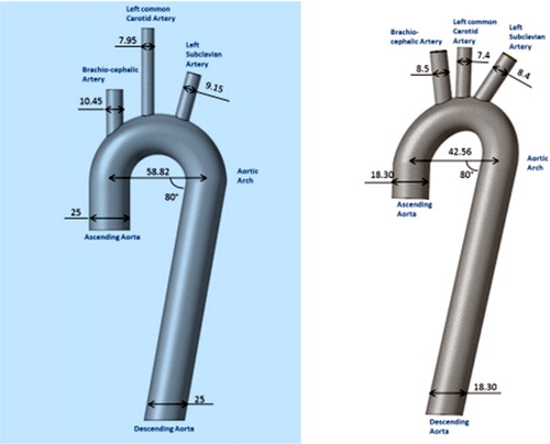 Figure 1. A) Model of the Aorta with the 50 percentile dimensions of geometry data. B) Model of the Aorta with the minimal dimensions of geometry data and ellipsoidal curvature of the aortic Arch.