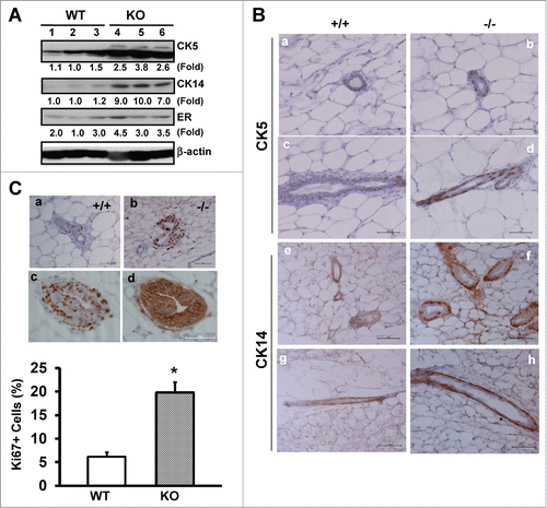 Figure 2. CD151 removal skews the distribution and proliferation of body and basal/cap or myoepithelial cells in murine mammary glands. (A) Expression of epithelial cell lineage-related genes in mammary tissues. Values indicate the relative fold changes in protein expression as determined by densitometry. Blotting for β-actin protein served as a loading control. (B) Typical IHC images of mammary tissue sections were stained with antibodies against cytokeratin 5 (CK5) or cytokeratin 14 (CK14). Staining is shown for CK5 (a-d) and CK14 (e-h) for WT (a, c, e and g) and CD151-null (b, d, f and h), respectively. (C) Representative images of IHC staining of Ki67 antigen in TEBs (a-b). Ki67 staining for WT (a) and CD151 KO mice (b). Consecutive sections of CD151-null mammary tissues were stained for Ki67 (c) and β-catenin (d), respectively. Bottom panel: Percentages of Ki67-positive cells. Values were determined by estimating the average numbers of Ki67-positive cells in 5 representative fields of stained tissue section (mean ± SEM, n = 3). *: P value <0.05. For (A–C), 7 week-old mice per genotype (n = 3) were analyzed. Scale bars for B & C: 50 μm.