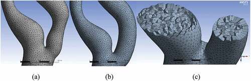 Figure 5. Meshed models: (a) stenosed model, (b) stented model, (c) Section view showing 3D tetrahedral elements.