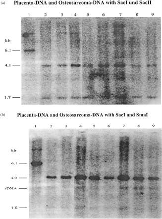 2 Southern blot analysis of tumor DNA with methylation-sensitive restriction enzymes SacII (Figure 2a) and SmaI (Figure 2b). DNA was digested with the indicated enzymes and analyzed by Southern Blot hybridization with p123. The probe identifies restriction fragments from the 5′end of the RB1 gene and a 28S rDNA fragment. This figure shows the results of digesting DNA of 7 tumors with SacI and SacII respectively SacI and SmaI. The osteosarcoma DNA show fragments as expected if SacII respectively SmaI restriction sites are not methylated. Kb = kilobases. (a) 1 = Placenta DNA as normal control only with SacI; 2 = placenta DNA with SacI and SacII; 3–9 = osteosarcoma DNA with SacI and SacII. (b) 1 = Placenta DNA only with SacI; 2 = placenta DNA with SacI and SmaI; 3–10 = osteosarcoma DNA with SacI and SmaI.