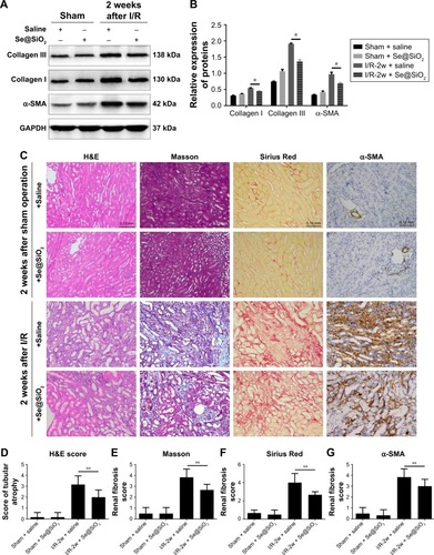 Figure 7 The effect of porous Se@SiO2 nanospheres on renal prognosis after AKI.Notes: (A, B) The expression levels of collagen I and III and α-SMA protein in mouse kidney tissues 2 weeks after I/R-induced AKI as detected by Western blotting. *P<0.05, I/R-2w + Se@SiO2 group vs I/R-2w + saline group. Data were expressed as means ± SDs (n=3). (C) Renal histology H&E and fibrosis staining in 2 weeks after AKI. Scale bars =0.15 mm. Data were expressed as means ± SDs (n=10). (D) H&E tubule atrophy score was used to assess the severity of tubule atrophy after AKI. **P<0.05. Data were expressed as means ± SDs (n=10). (E–G) Masson trichrome staining, Sirius Red staining, and α-SMA immunohistochemical staining were used to assess the severity of renal fibrosis by proportion score. **P<0.05, I/R-2w + Se@SiO2 group vs I/R-2w + saline group. Data were expressed as means ± SDs (n=10).Abbreviations: α-SMA, α-smooth muscle actin; GAPDH, glyceraldehyde-3-phosphate dehydrogenase; 2w, 2 weeks; I/R, ischemia/reperfusion; AKI, acute kidney injury.