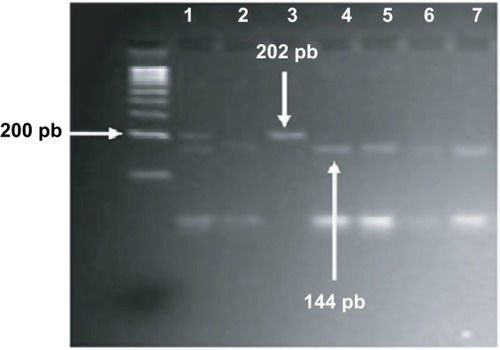 Figure 2 Gel electrophoresis of c.-912T>C polymorphism.