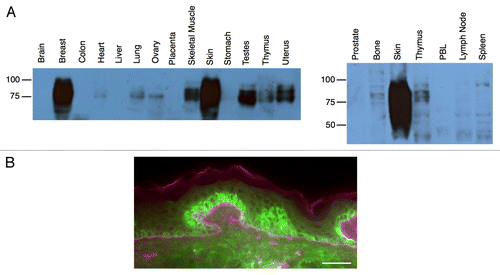 Figure 4. TMC8 protein expression. Expression analysis of transmembrane channel-like 8 (TMC8) by western blot (A) and immunofluorescence staining (B). (A) Human tissue lysates (15 μg, BioChain) were boiled in reducing sample buffer, resolved by 10% SDS-PAGE, transferred to PVDF membrane and probed with an anti-TMC8 antibody (Bethyl Labs). (B) Frozen human skin section (Biochain, CA) stained with antibodies against TMC8 (Bethyl Labs, green) and basal lamina marker laminin (US Biological, purple). Scale bar: 200 µm.