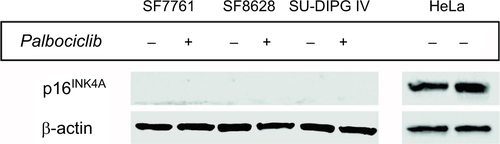 Figure S1 DIPG cells, ostensibly, do not express p16INK4A.Notes: Immunoblot using p16INK4A-specific antibody against protein from SF7761, SF8628, and SU-DIPG IV cells treated with vehicle (−) or 10 μM palbociclib (+) for 24 hours. HeLa cell protein was used as a positive control for p16INK4A expression. ®-actin was used as a loading control. Representative immunoblot of three determinations.Abbreviation: p16INK4A, cyclin-dependent kinase inhibitor 2A.