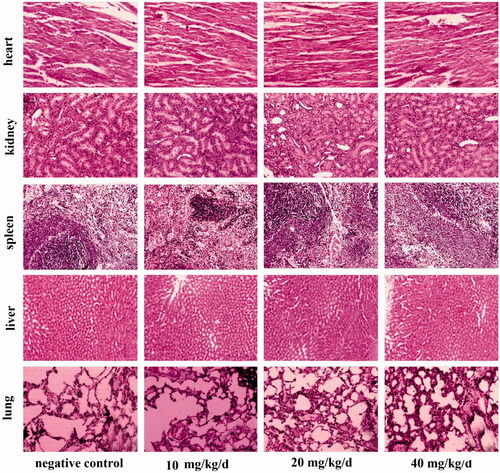 Figure 5. HE staining of the liver, kidney, heart, spleen and lung in mice. Images are at 200 × magnification.