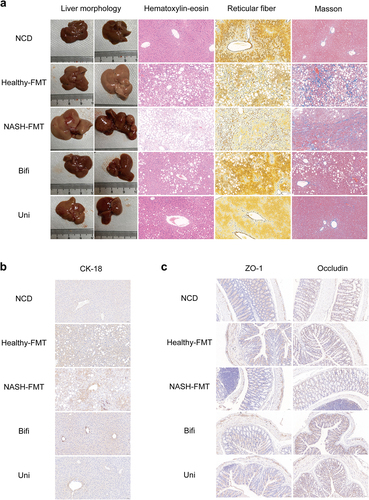 Figure 4. B. uniformis and B. bifidum improved liver histopathology and the intestinal mucosal barrier in HFD-induced NASH mice. (a) Representative images of liver morphology, H&E, reticular fiber and Masson staining of mice in different groups. Bar: 50 μm. (b) Representative images of immunohistochemistry of hepatic CK-18. Bar: 50 μm. (c) Representative images of immunohistochemistry of colorectal occludin and ZO-1. Bar: 50 μm.