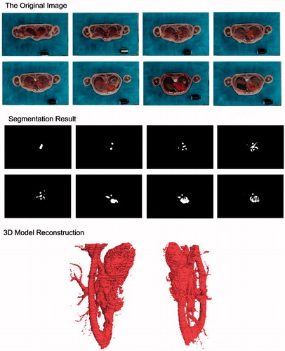 Figure 10. Aortic circulatory system image segmentation and 3D construction of female virtual human in China.