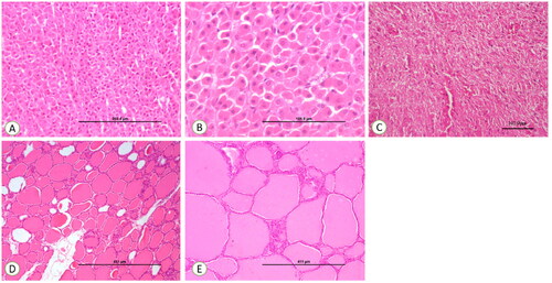 Figure 5. (A) Control section of the adrenal gland, ×200. (B) Control section of the adrenal gland, ×400. (C) Control section of thyroid, ×100. (D) Control section of thyroid, ×200. (E) Control section of the pituitary gland showing normal pituicytes, ×200.