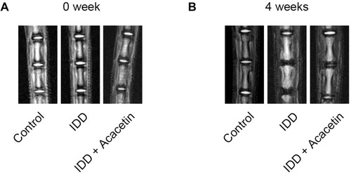 Figure 5 MRI evaluation of rat intervertebral disc. (A) T2-weighted MRI images of the rat tails immediately after the operation; (B) T2-weighted MRI images of the rat tails four weeks after the operation.