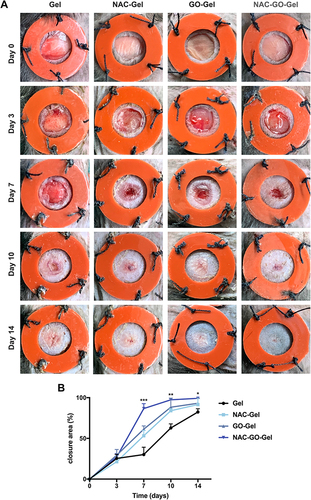 Figure 5 In vivo wound healing evaluation of Gel, NAC-Gel, GO-Gel, and NAC-GO-Gel scaffolds. (A) Photographic evaluation of wound repair in four groups on day 0, 3, 7, 10, and 14; (B) closure area (%) of the wound defect. NAC-GO-Gel group achieved the best effect among four groups on day 7, 10, and 14 (mean ± SD, ***P < 0.001, **P<0.01, *P<0.05).