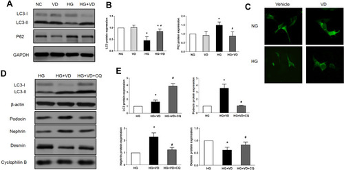 Figure 8 The protective effects of calcitriol against high-glucose induced injury are blocked by autophagy inhibitor chloroquine. MPC5 were cultured for 24 h in medium with 30 mM or 5.5 mM glucose in the absence or presence of 100 nmol/L calcitriol. Cells were collected for immunoblot analysis of LC3 and p62 (A and B) or fixed for immunofluorescent microphotographs of GFP-LC3-transfected podocytes (400×) (C). Podocytes were treated with 100 nmol/L calcitriol with and without 20 μM chloroquine (CQ) for 24 hours under high glucose condition. Whole cell lysate were collected for immunoblot analysis of LC3, nephrin, podocin and desmin (D and E). Values are mean ± SD (n=3). Significance: *P<0.05 vs respective control group, # P<0.05 vs DN group at the same time point, respectively.