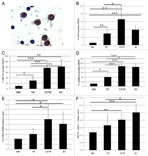 Figure 2. Enhanced autophagy in PBMC from LTNP and EC. (A) Immunocytochemical localization of BECN1 on PBMC from LTNP. (B–D) The percentage of cells expressing ATG5, BECN1, and AMBRA1 was quantified. (E) WB analysis of LC3-II levels on PBMC. (F) qRT-PCR of BECN1 mRNA relative level. Original magnification: (A) 100×. *P < 0.05, **P < 0.01, ***P < 0.001.