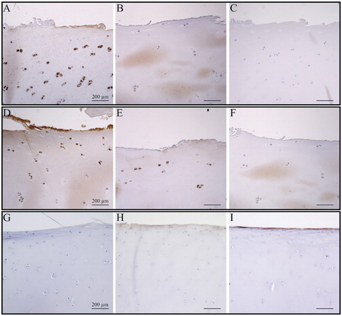 Figure 1. TLR3 and TLR4 expression in cartilage from hand and knee OA joints. A–C. Eaton-Glickel grade-2 CMC-I OA stained for TLR3 and TLR4, together with a negative staining control (panel C). D–F. OARSI grade-2 knee OA stained for TLR3 and TLR4, together with a negative staining control (panel F). G–I, healthy control CMC-III stained for TLR3 and TLR4, together with a negative staining control (panel I). Magnification: 100×.