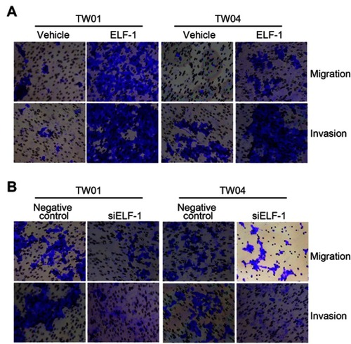 Figure S1 Effects of ELF-1 on the migration and invasion of NPC cells. (A and B) The images of migration and invasion of ELF-1-overexpressing and ELF-1-depleted NPC cells were assessed using Transwell assays.Abbreviation: NPC, nasopharyngeal carcinoma.