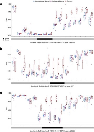 Figure 5. Distribution of the methylation status at interrogated CpG loci in the promoter CpG island and surrounding CpG island shores across contralateral normal, ipsilateral normal, and tumour tissue for (a) FAAP20 (b) SST and (c) VGLL4.