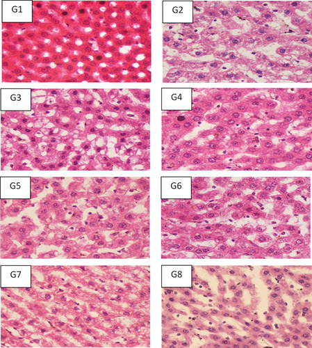 Figure 7. Hepatic histopathological analysis of the rats fed with probiotics, prebiotics and combination of pro/prebiotics100x after staining with Hematoxylin and Eosin stain.