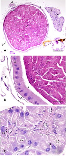 Figure 6. Photomicrographs of the spermatheca with its glands and ducts: (A) Low magnification image of the spermatheca (1) containing sperm (2); spermathecal glands (3) and spermathecal duct (4) (bar = 200µm); (B) The spermatheca is lined by simple cuboidal epithelium (5) on a thin, anucleate, basophilic basement membrane (6) with an overlying thin, basophilic cuticle (7). The spermatheca is surrounded by tracheal network (8). The fecundated spermatheca is filled with tightly packed spermatozoa (2) (bar = 20µm); (C) The spermathecal glands are lined by an external glandular epithelial layer (9), formed by tall, columnar epithelium that has large, basal nuclei and foamy cytoplasm with at least one, distinct, apical, intracytoplasmic vacuole (10), on a basophilic membrane formed by attenuated epithelium (11). The inner intima (12) is formed by smaller, tall columnar cells with basal nuclei and multiple intracytoplasmic canaliculi (13). The glandular lumen is covered by amorphous amphophilic material (14) (bar = 20µm).