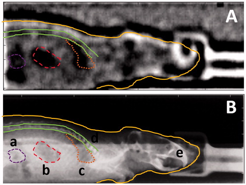 Figure 3. (A) Proton radiography image acquired in scattering mode. (B) Planar X-ray scan of the same mouse prior to proton radiography acquisition. Both images were cropped with the bedding unit used as landmark. The markers indicate the contours of internal and external structures of the mouse that could be identified in the planar X-ray image. Structures that could be distinguished were (a) abdominal intestines, (b) the stomach, (c) the lung, (d) the vertebral spine and (e) the body contour of the mouse. These contours are also shown in the proton radiography image (A) for illustration.