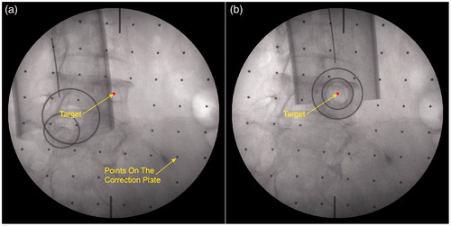 Figure 7. Fluoroscopy images of end-effector in clinical application. a) The fluoroscopy image before alignment; b) The fluoroscopy image after alignment.