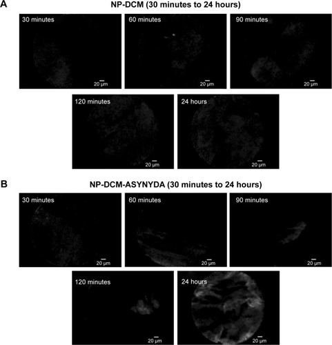 Figure 6 Confocal imaging of rat esophageal adenocarcinoma upon intravenous administration of NPs.Notes: (A) CLE images upon intravenous administration of NP-DCM were acquired after 30, 60, 90, 120 minutes, and 24 hours. Their weak and diffuse fluorescent signal became noticeable after 30 minutes and was stronger and more localized after 24 hours. (B) CLE images upon intravenous administration of NP-DCM-ASYNYDA were acquired after 30, 60, 90, 120 minutes, and 24 hours. The fluorescent signal was particularly strong and specific after 24 hours.Abbreviations: DCM, 4-(dicyanomethylene)-2-methyl-6-(4-dimethylaminostyryl)-4H-pyran; CLE, confocal laser endomicroscopy; NP, nanoparticle.