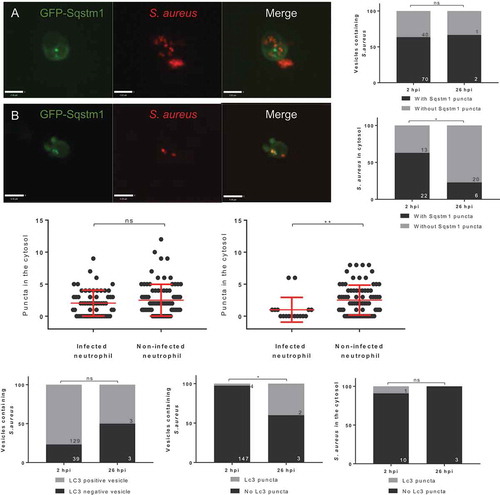 Figure 2. In vivo recruitment of GFP-Sqstm1 puncta during S. aureus infection. (A) Representative image of S. aureus observed within a likely “vesicle” with GFP-Sqstm1 puncta localization, (scale: 7 µm) (B) representative image of S. aureus observed within the cytosol with GFP-Sqstm1 puncta localization, (scale: 9 µm) (C) S. aureus within vesicles, co-localized with GFP-Sqstm1 at 2 hpi and 26 hpi (CHT imaged, ns, Fisher’s exact test, n = 3, 14 larvae at 2 hpi, and 12 larvae at 26 hpi) (D) S. aureus in the cytosol, co-localized with GFP-Sqstm1 at 2 hpi and 26 hpi (CHT imaged, *p < 0.05, Fisher’s exact test, n = 3, 14 larvae at 2 hpi, and 12 larvae at 26 hpi) (E) GFP-Sqstm1 puncta in the cytosol of infected and non-infected at 2 hpi (CHT imaged, ns, Mann-Whitney test, n = 3, error bars ± SD, 14 larvae) (F) GFP-Sqstm1 puncta in the cytosol of infected and non-infected at 26 hpi (CHT imaged, **p < 0.01, Mann-Whitney test, n = 3, error bars ± SD, 12 larvae) (G-I) 2500 cfu of GFP S. aureus injected into Tg(lyzC:RFP-GFP-lc3)sh383, larvae imaged in the CHT at 2 hpi and 26 hpi. (G) Lc3 association to the entire S. aureus vesicle at 2 hpi and 26 hpi (ns, Fisher’s test, n = 3, 17 2 hpi larvae, 11 26 hpi larvae) (H) The number of S. aureus vesicles with Lc3 puncta (*p < 0.05, Fisher’s test, n = 3, 17 2 hpi larvae, 11 26 hpi larvae) (I) The number of S. aureus events in the cytosol with Lc3 puncta at 2 hpi and 26 hpi (ns, Fisher’s test, n = 3, 17 larvae at 2 hpi, 11 larvae at 26 hpi)