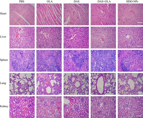 Figure 13 HE staining of various organs in BALB/c nude mice harboring MDA-MB-231 tumor xenografts after different treatments. Scale bar = 200μm. The red circles indicate the sites of organ damage.