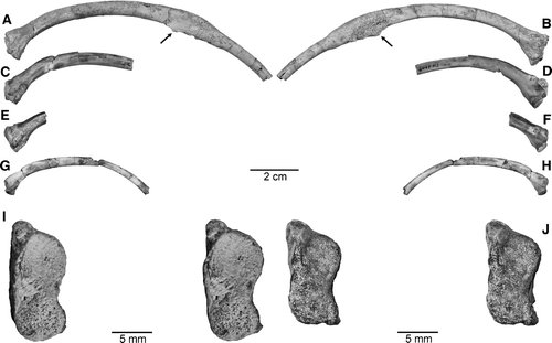 FIGURE 4 Ribs and rib fragments of Madtsoia madagascariensis from the Late Cretaceous of Madagascar. A, anterior; and B, posterior views of UA 9764, nearly complete left rib exhibiting a pathological lesion (indicated by arrows). C, anterior; D, posterior; and I, stereophotographic proximal views of UA 9746, proximal half of right rib (reversed to facilitate comparison). E, anterior; F, posterior; and J, stereophotographic proximal views of FMNH PR 2571, proximal fragment of left rib. G, anterior; and H, posterior views of UA 9763, nearly complete left rib.