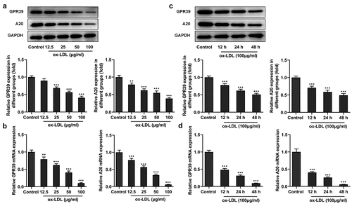 Figure 1. Decreased expression of GPR39 and A20 in ox-LDL-challenged macrophages. (a-b) Relative protein and mRNA expression of GPR39 and A20 after stimulation with 12.5, 25, 50 and 100 μg/ml of ox-LDL, detected by western blot assay and RT-qPCR. (c-d) Relative protein and mRNA expression of GPR39 and A20 after stimulation with 100 μg/ml of ox-LDL, detected by western blot and RT-qPCR assays. **P < 0.01, ***P < 0.001 vs. Control