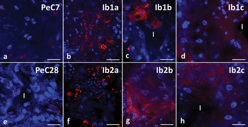 Figure 10. Midgut of Pam. experimentalis stained with LysoTracker Red and DAPI, confocal microscopy. Nuclei (blue signals), acidic organelles (red signals). (a;e) Autophagy in midgut of Pam. experimentalis in control groups, (a) bar = 12.93 μm, (e) bar = 10.53 μm. (b) Autophagy in midgut of Pam. experimentalis treated with ibuprofen for 7 days; concentration of ibuprofen 0.1 μg/L – Ib1a, bar = 14.29 μm. (c) Autophagy in midgut of Pam. experimentalis treated with ibuprofen for 7 days; concentration of ibuprofen 16.8 μg/L – Ib1b, bar = 11.11 μm. (d) Autophagy in midgut of Pam. experimentalis treated with ibuprofen for 7 days; concentration of ibuprofen 1 mg/L – Ib1c, bar = 10 μm. (f) Autophagy in midgut of Pam. experimentalis treated with ibuprofen for 28 days; concentration of ibuprofen 0.1 μg/L – Ib2a, bar = 8.33 μm. (g) Autophagy in midgut of Pam. experimentalis treated with ibuprofen for 28 days; concentration of ibuprofen 16.8 μg/L – Ib2b, bar = 12.5 μm. (h) Autophagy in midgut of Pam. experimentalis treated with ibuprofen for 28 days; concentration of ibuprofen 1 mg/L – Ib2c, bar = 10 μm.