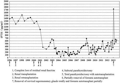 Figure 1. The fluctuation of serum parathyroid hormone (PTH) level during 1996–2013. Serum concentration of PTH was 444.35 ± 379.30 (range 30–1725) pg/mL. Numerical symbols 1–7 represent operations done in 1996–2013, respectively. Pharmacological medication of SHPT (phosphate binder, active vitamin D) was used in the course of dialysis treatment.