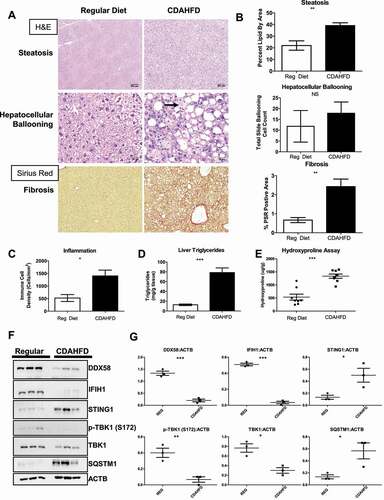 Figure 1. DDX58 protein is reduced in NAFLD/NASH mouse models. Eight mice were fed a regular chow diet and eight mice were fed a CDAHFD diet. Analysis is represented of all sixteen mice. (A) Liver tissues from mice on a standard chow diet versus and CDAHFD diet were stained for H&E to detect NASH histopathologies. Picrosirius red (PSR) was used to detect fibrosis in the liver. Scale bar: 200 μm. (B) Quantification of steatosis by percent of total area contain unstained lipid vacuoles, total number of ballooning cells and fibrosis by total area stained with PSR Scale bar: 20 μm. (C) To determine inflammation immune cell density was measured and quantified in H&E-stained liver tissue. CDAHFD mice have a significant increase in immune cells. (D) NASH model showed increased triglycerides content in collagen in CDAHFD mice. (E) Hydroxyproline showed a significant increase in collagen in the CDAHFD model. (F) Immunoblots showed a decrease in DDX58, IFIH1, and increase in STING1. (G) Quantification of immunoblots using ImageJ software to perform densitometry analysis. All statistics in this figure used an unpaired t-test (*P < 0.05; **P < 0.01; ***P < 0.001), error bars represent SEM.