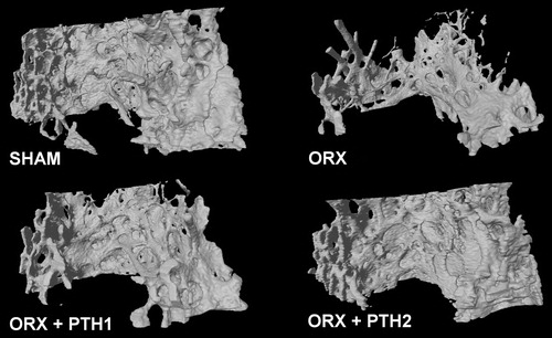 Figure 3. Representative images of bone trabecular 3D microarchitecture in distal femur obtained by microcomputed tomography. Study formed by sham-operated rats (SHAM), castrated rats (orchidectomy: ORX) and castrated rats treated for three months with PTH 10 mg/kg/d (ORX + PTH1) and PTH 50 mg/kg/d (ORX + PTH2).