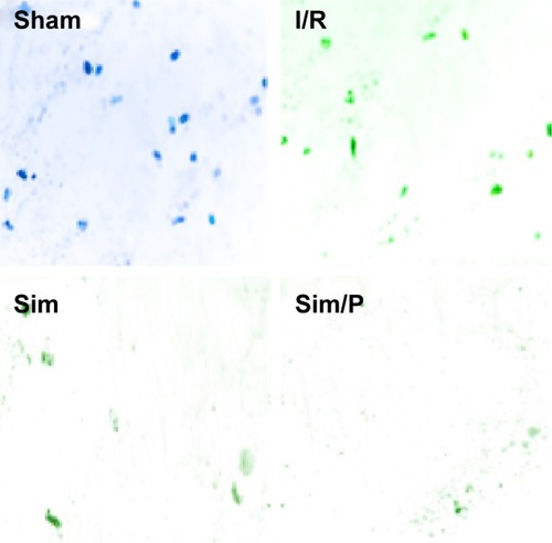 Figure 6 Expression of ROS in different groups of rats.Notes: The intestinal tissues of Sham, I/R, Sim, and Sim/P group rats were collected 1 h after reperfusion and the expression of ROS measured. ROS expression in I/R group rats was higher than that in the Sham group; ROS expression in Sim group rats was less than that in the I/R group; ROS expression in Sim/P group rats was significantly less than that in the I/R group.Abbreviations: I/R, ischemia/reperfusion; ROS, reactive oxygen species; Sim, simvastatin; Sim/P, simvastatin/PEG-b-PBLG50.