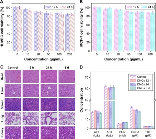 Figure 2 Cell viabilities of (A) HUVEC and (B) MCF-7 cells at different dosages of the DNCs (0, 10, 20, 50, 100, 200 µg/mL). (C) H&E images of heart, liver, spleen, lung, and kidney at 12 h, 24 h, and 5 days after intravenous injection of DNCs (magnification: ×100). (D) Serum biochemistry data for mice injected with saline solution and with DNCs (12 h, 24 h, and 5 days post-injection).Notes: DNCs, dual-targeted gold nanoshelled poly(lactic-co-glycolic acid) nanocapsules carrying anti-vascular endothelial growth factor receptor type 2 antibody and anti-p53 antibody. Concentration units of measure in (D) were (U/L, mM, µM).Abbreviations: ALT, alanine aminotransferase; AST, aspartate aminotransferase; BUN, blood urea nitrogen; CREA, creatinine; HUVEC, human umbilical vein endothelial cells; H&E, hematoxylin and eosin; TBIL, total bilirubin.